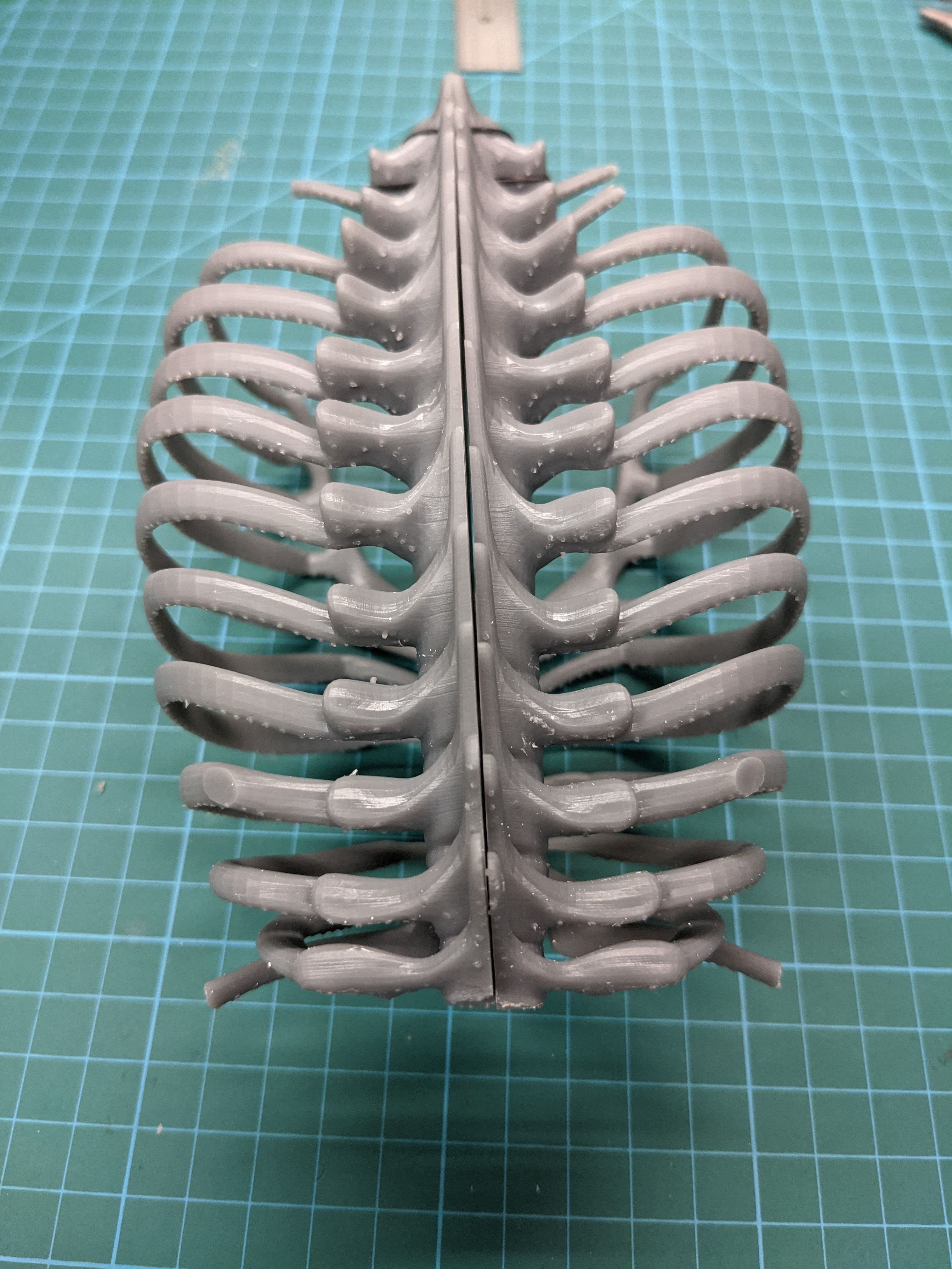 rib cage 3